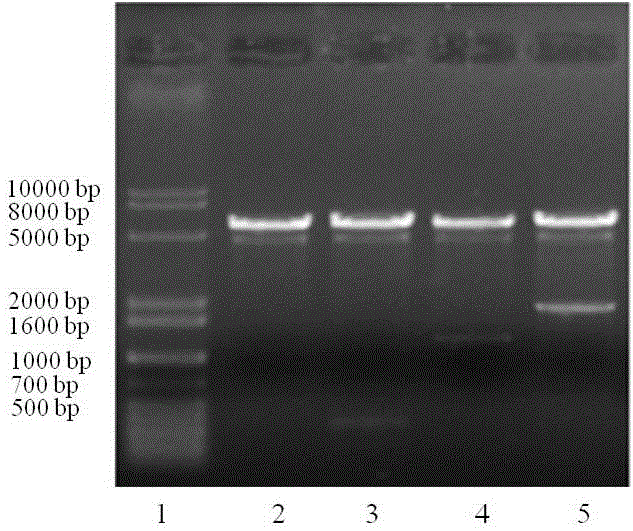 Construction and identification of Mycobacterium tuberculosis CFP10-38kD-19kD fusion protein