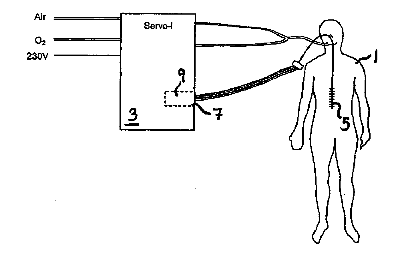 Catheter positioning method and computerized control unit for implementing the method