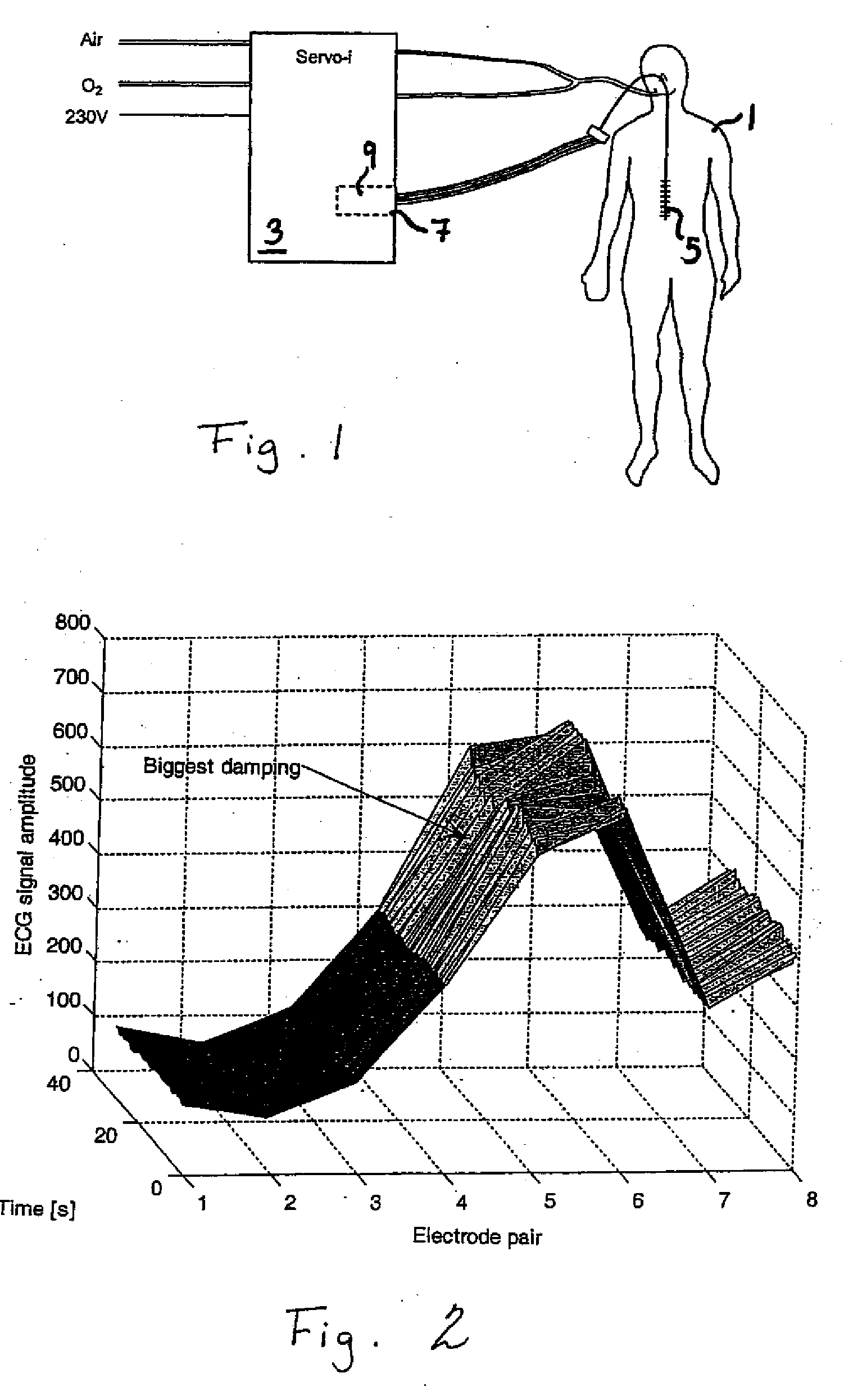 Catheter positioning method and computerized control unit for implementing the method