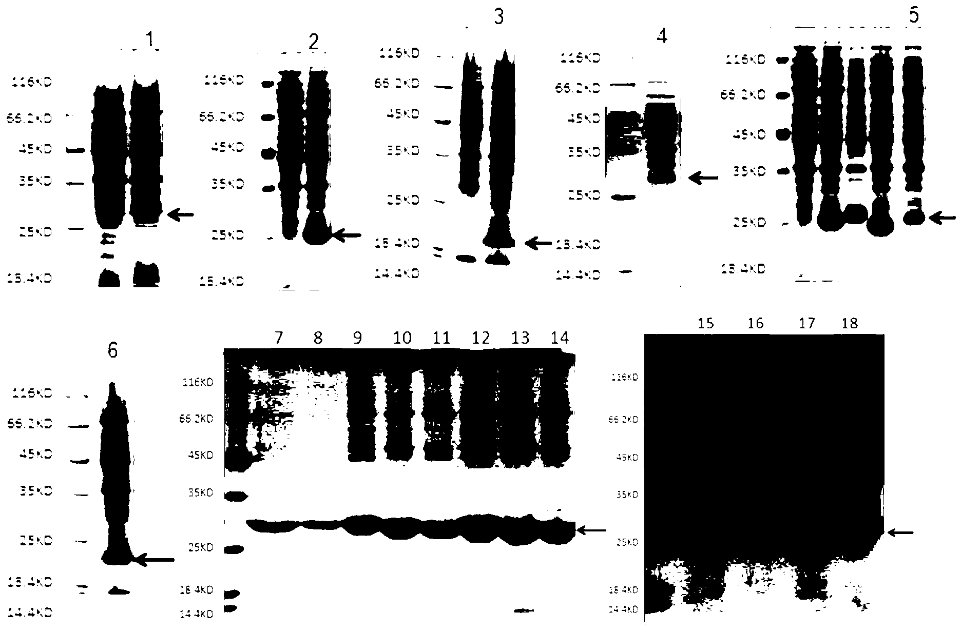 Fusion protein with double functions of inhibiting revascularization of tumor microenvironment and activating adaptive immune response, and gene and application thereof