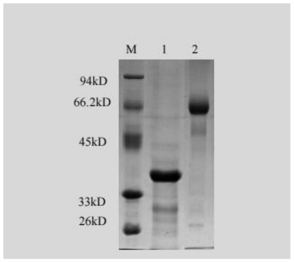 Monoclonal antibody against DOG1 protein and cell strain, preparation method and application thereof