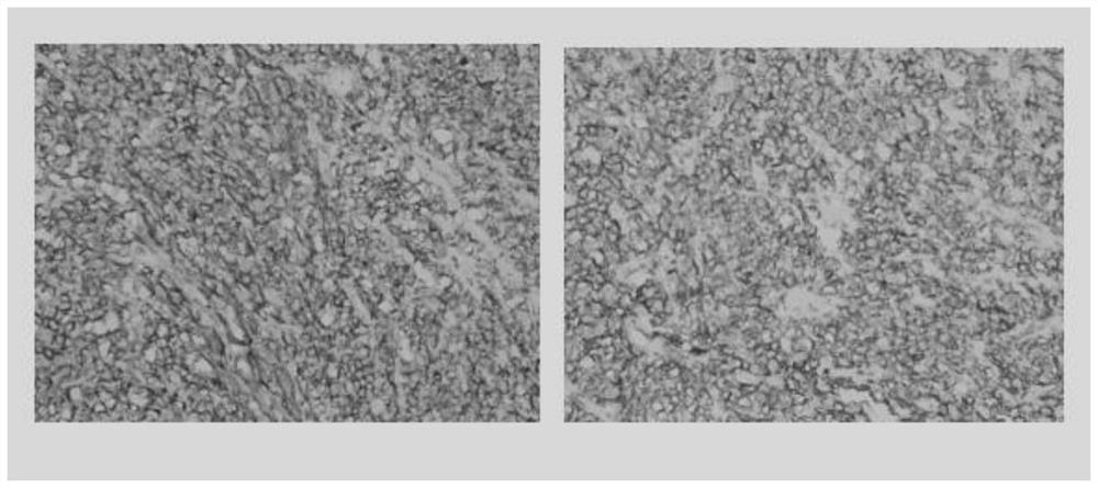 Monoclonal antibody against DOG1 protein and cell strain, preparation method and application thereof