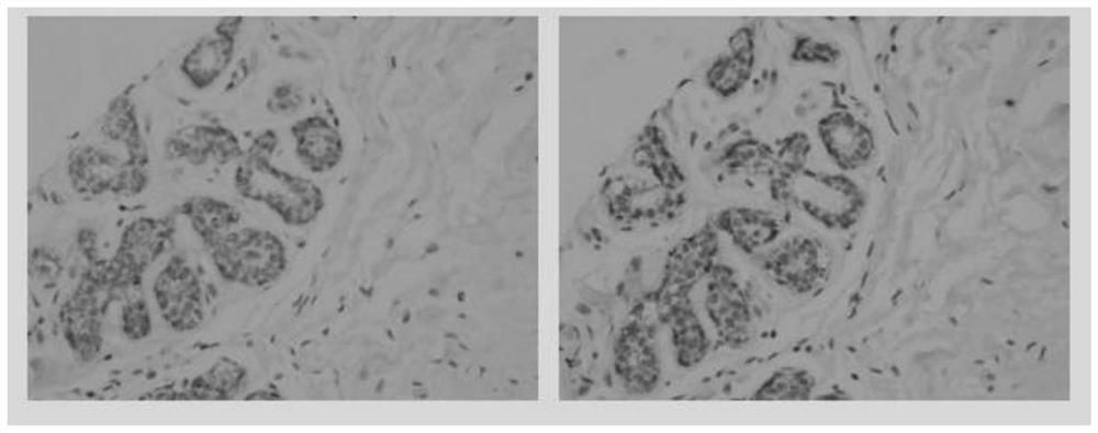 Monoclonal antibody against DOG1 protein and cell strain, preparation method and application thereof