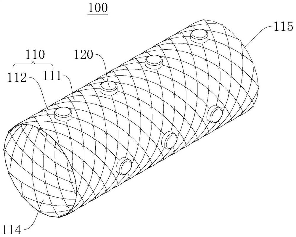 Silicone stent, implanting system and manufacturing method