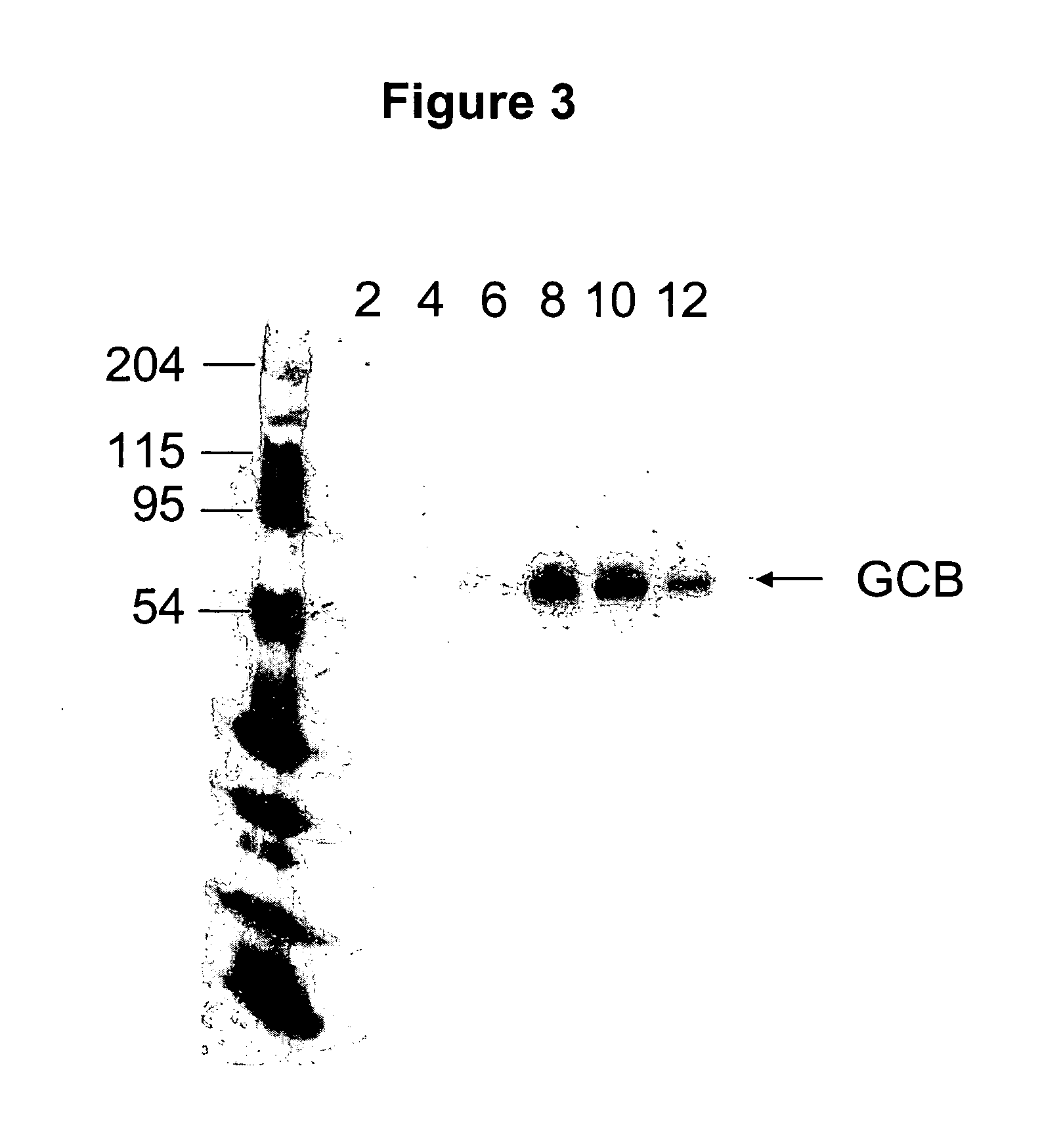 Glycosylated glucocerebrosidase expression in fungal hosts