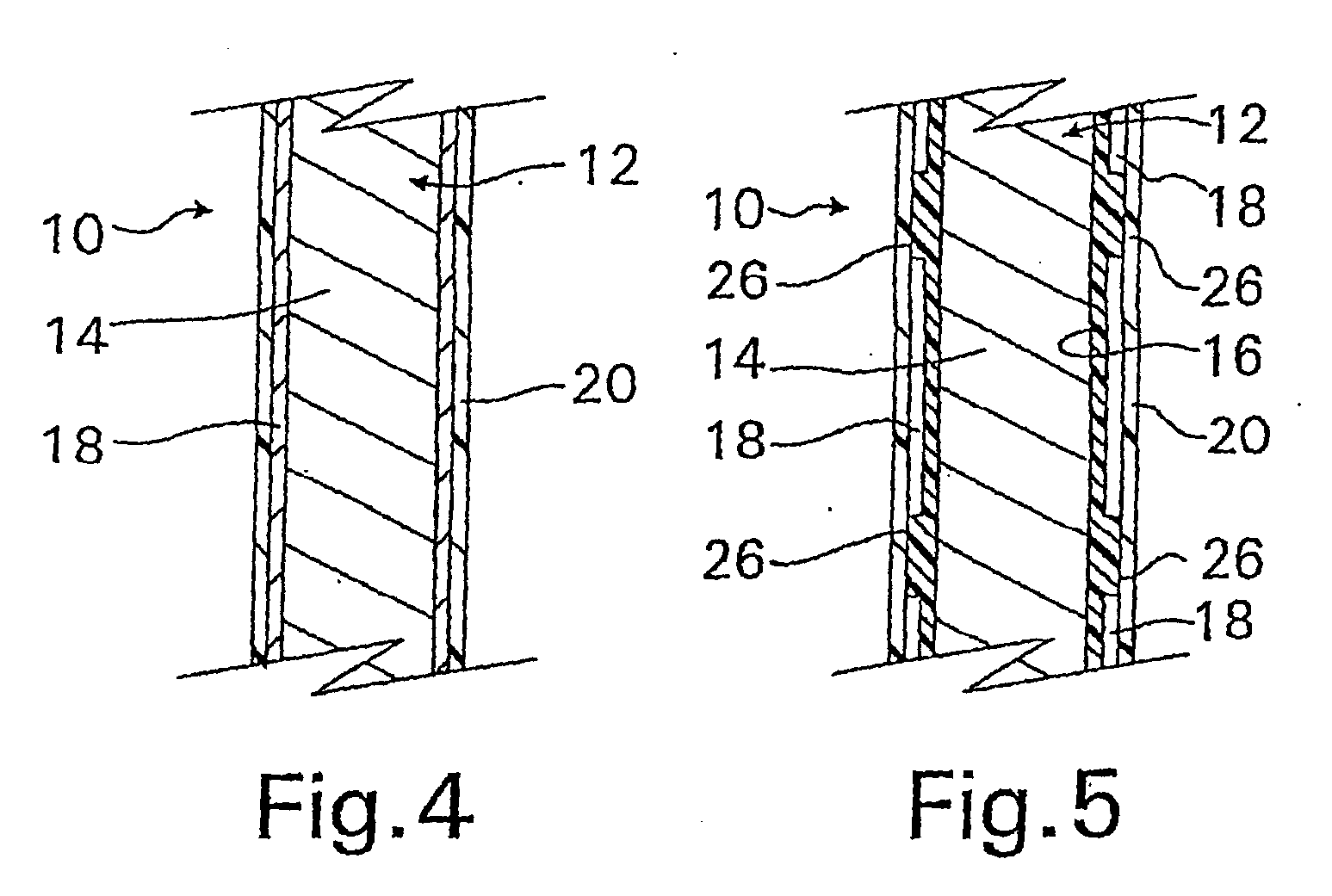 Coated implantable medical device