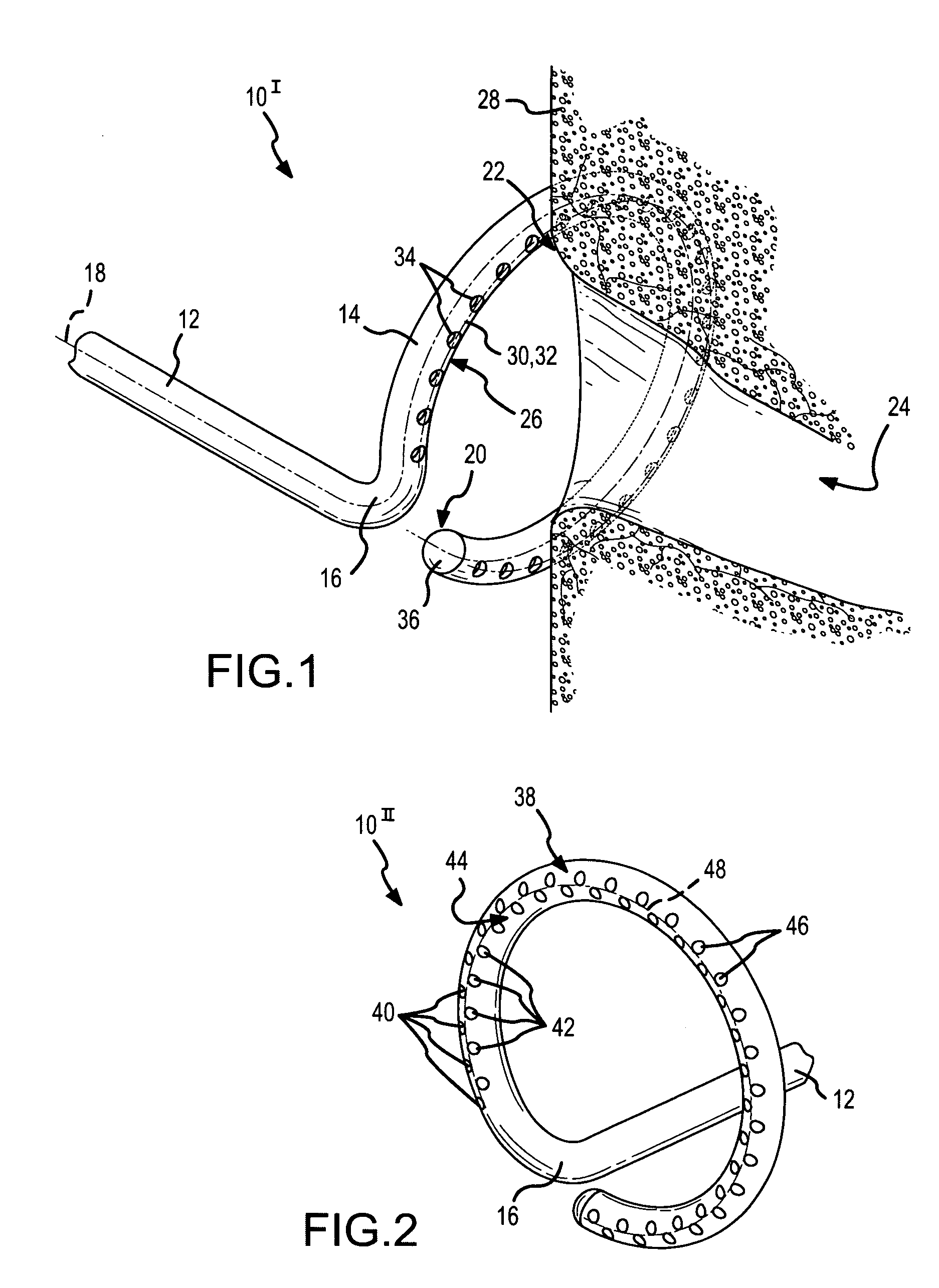Treatment and diagnostic catheters with hydrogel electrodes
