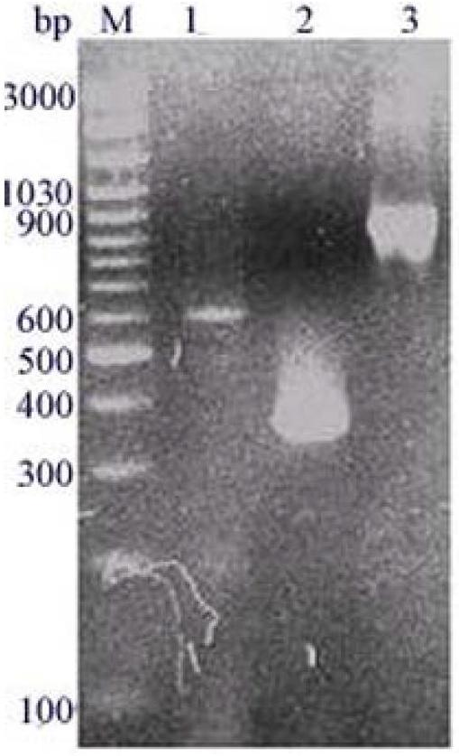 Preparation method of hybrid xylanase atxb