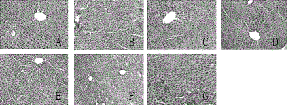 Health care product with function of protecting alcoholic liver injury