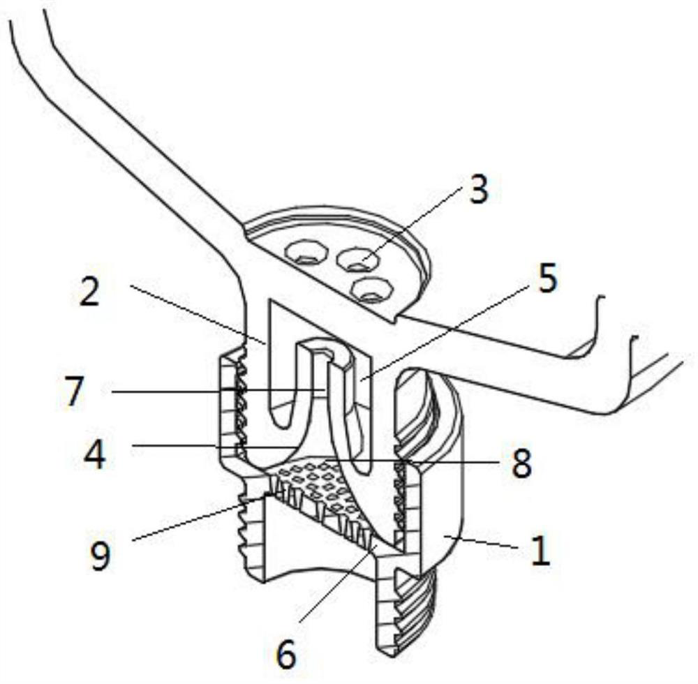 Micro-nano foaming mechanism and micro-nano bubble water device