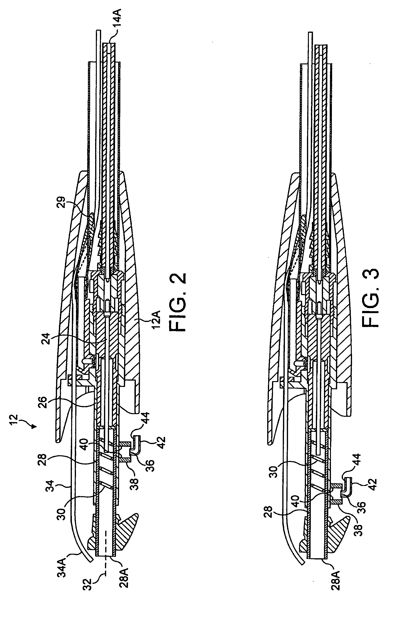 Tissue treatment apparatus