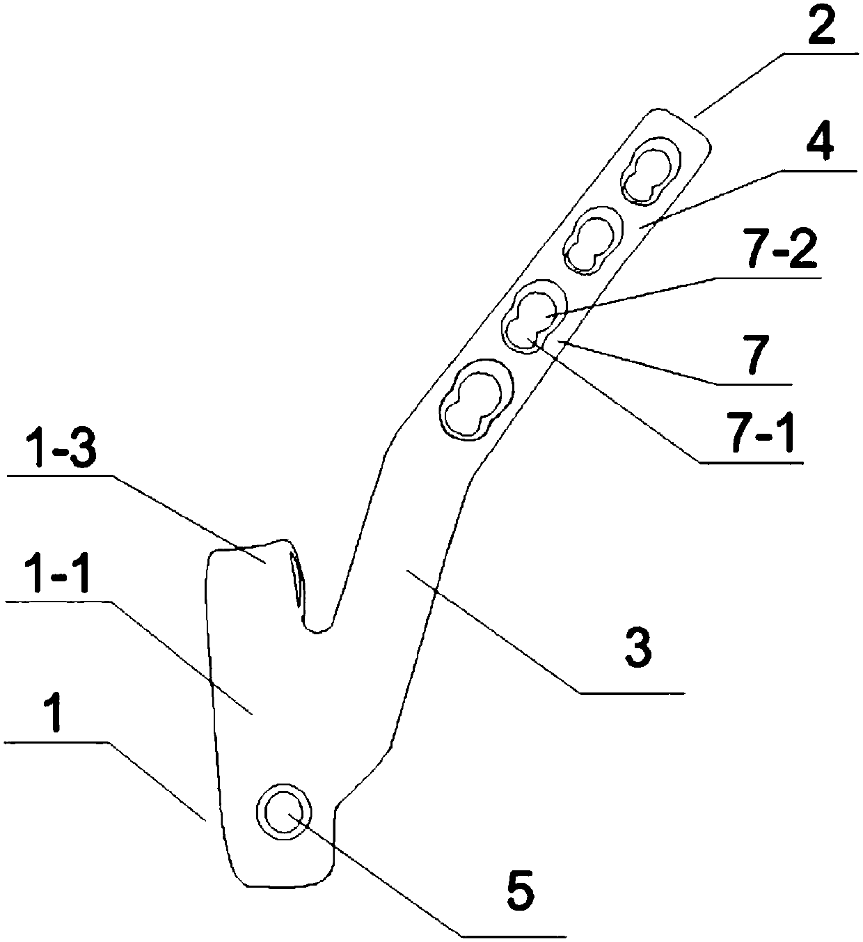 Novel dissection locking steel plate for sternoclavicular joint and matched barrier plate