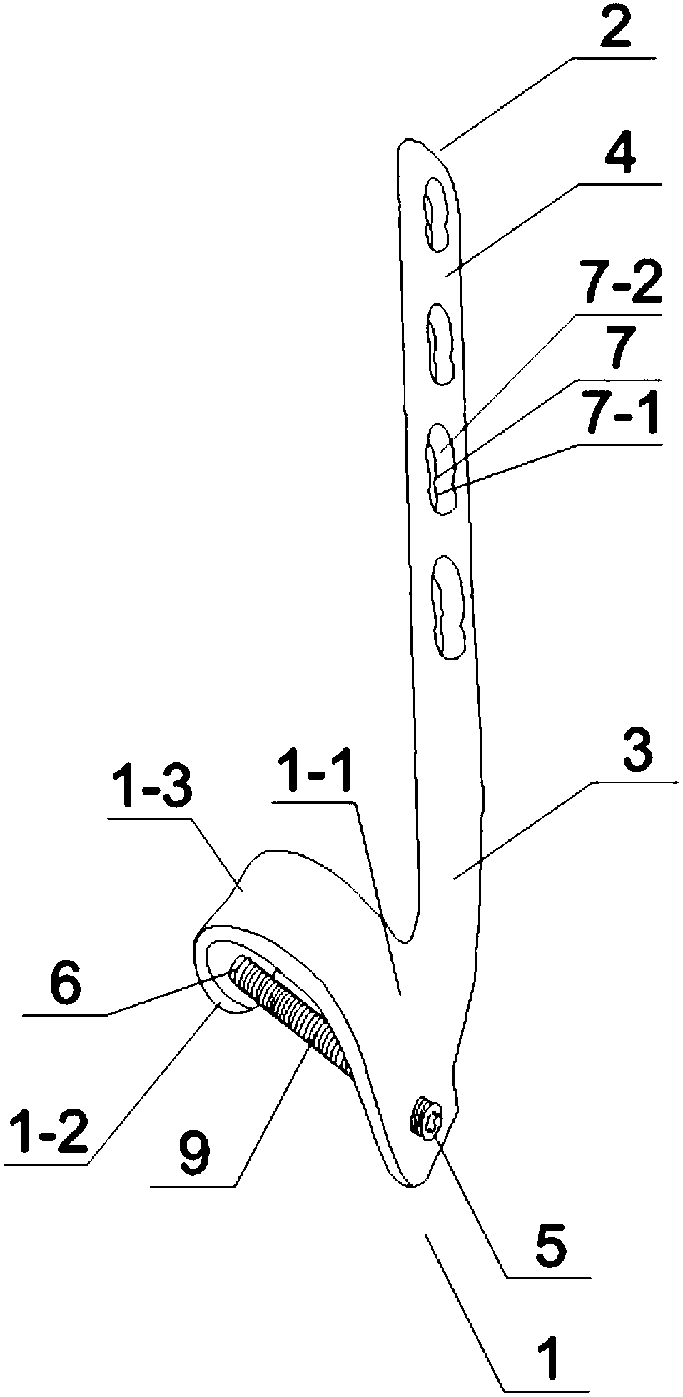 Novel dissection locking steel plate for sternoclavicular joint and matched barrier plate