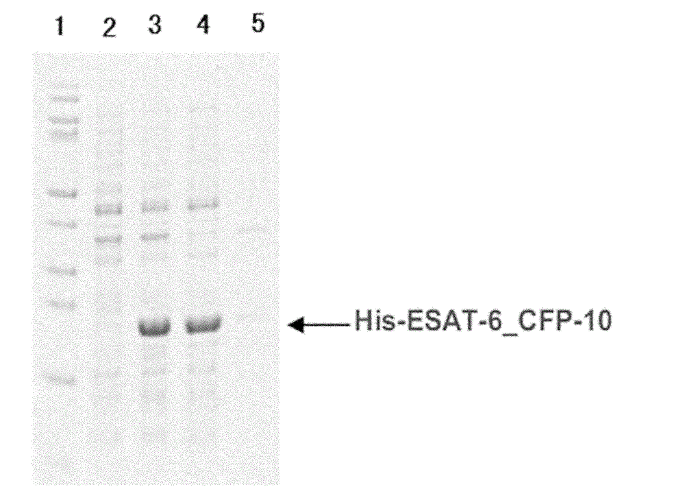 Whole blood INF-gamma specific antigen protein and preparation method and application thereof