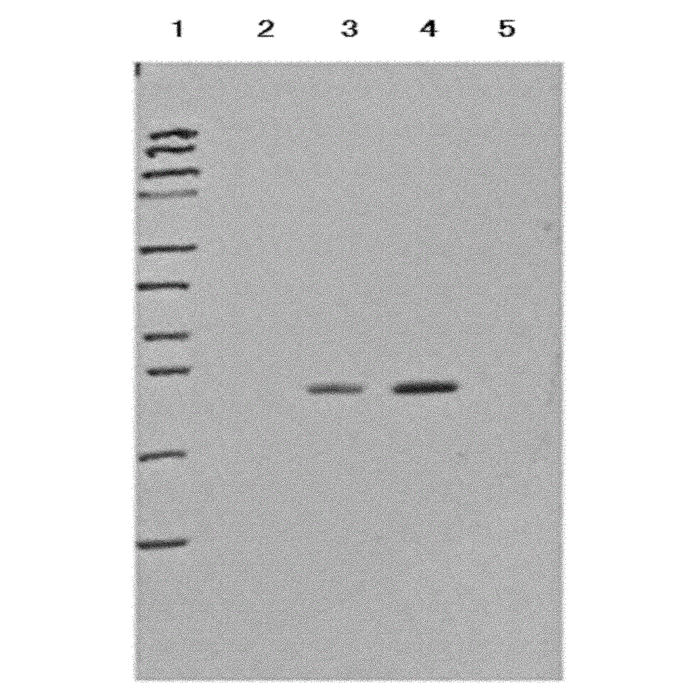 Whole blood INF-gamma specific antigen protein and preparation method and application thereof