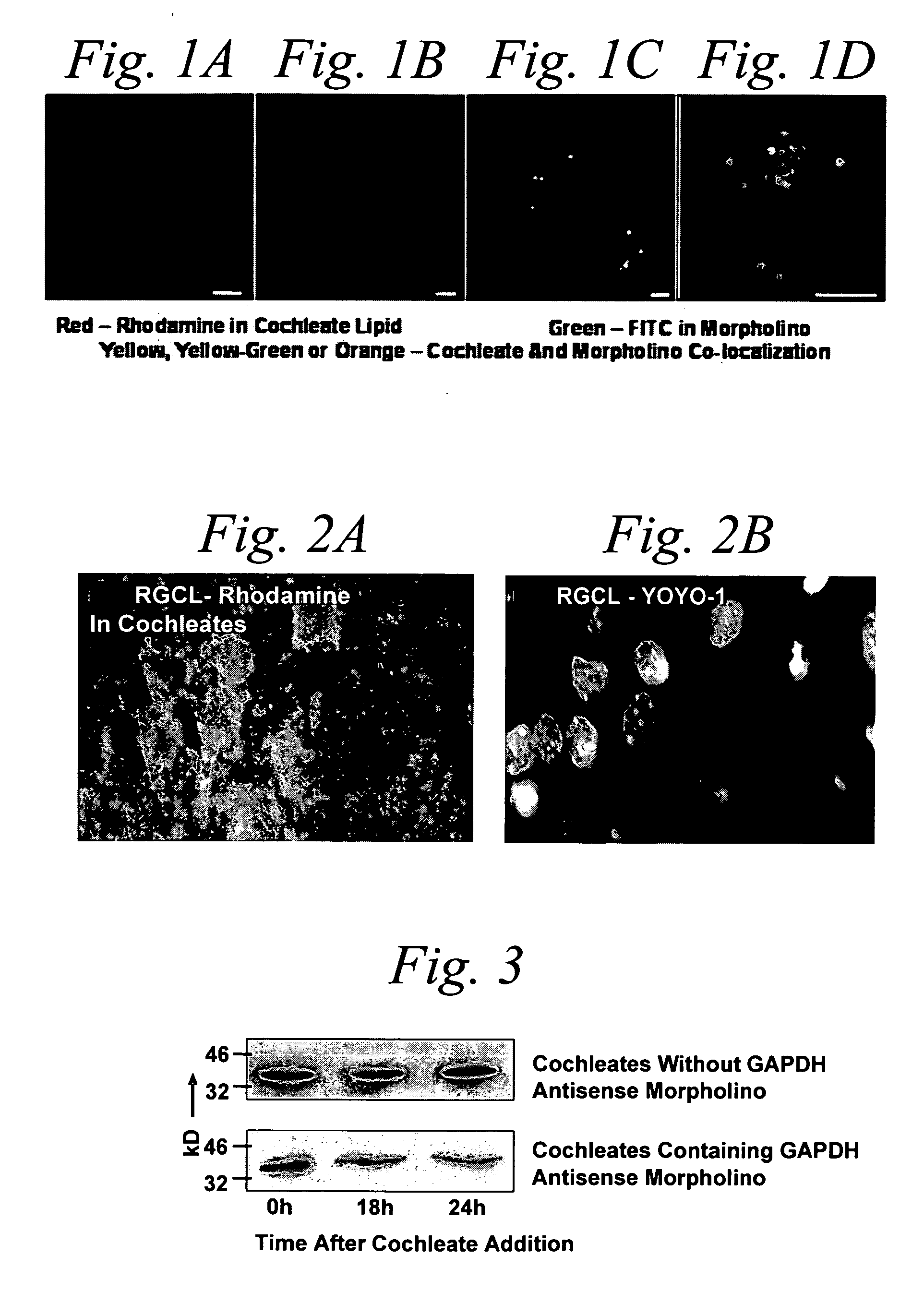 Cochleate compositions directed against expression of proteins - Eureka ...