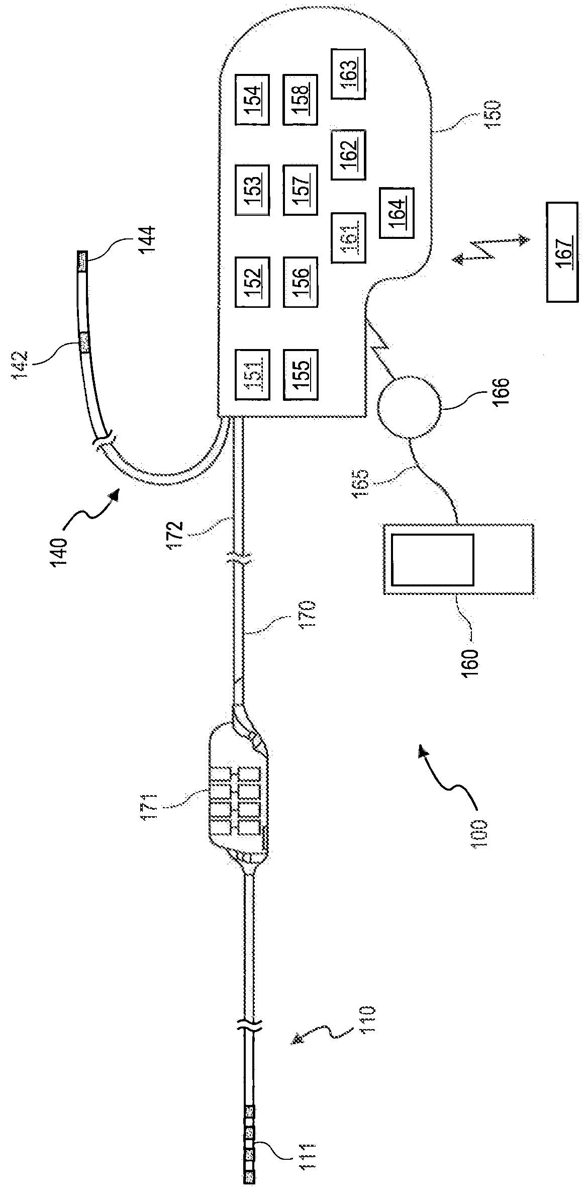 Neurostimulation method and system to treat apnea