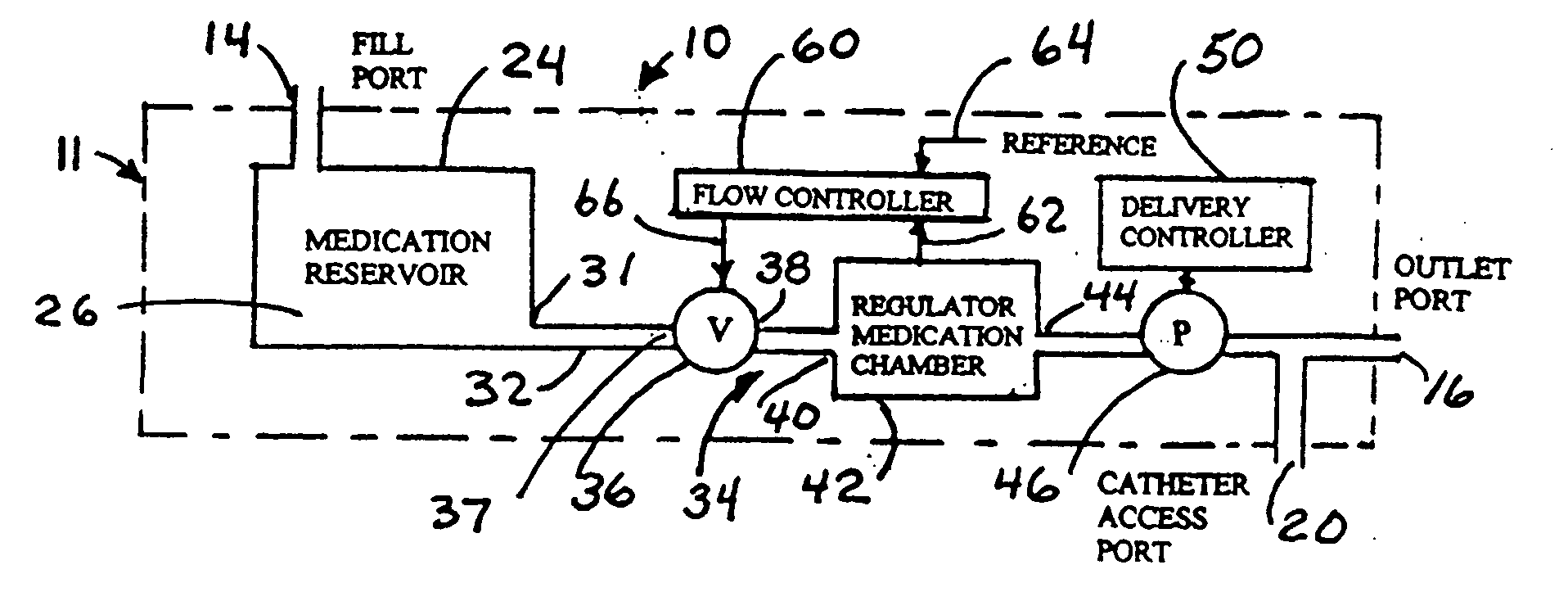 Implantable medication delivery device using pressure regulator