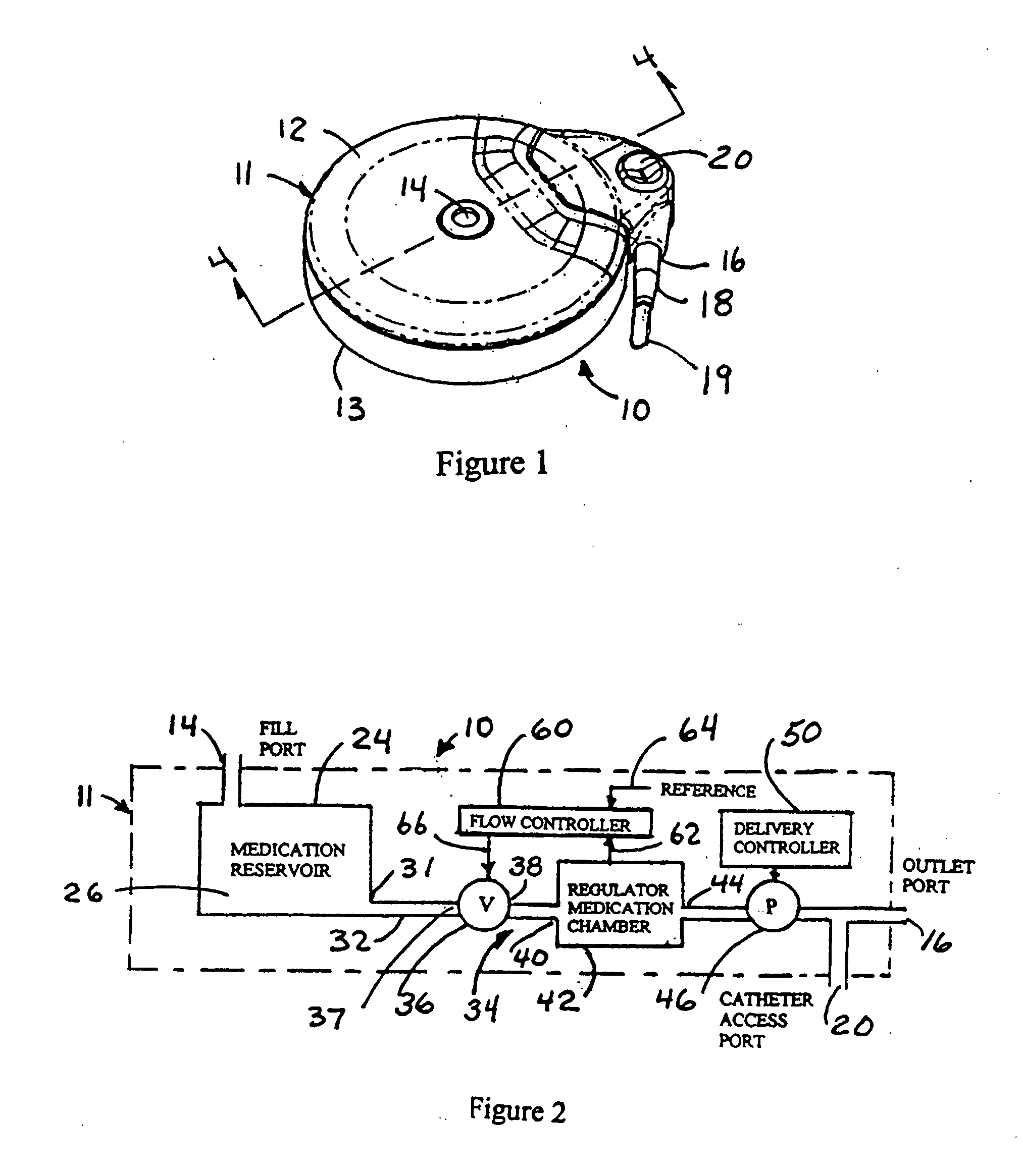 Implantable medication delivery device using pressure regulator