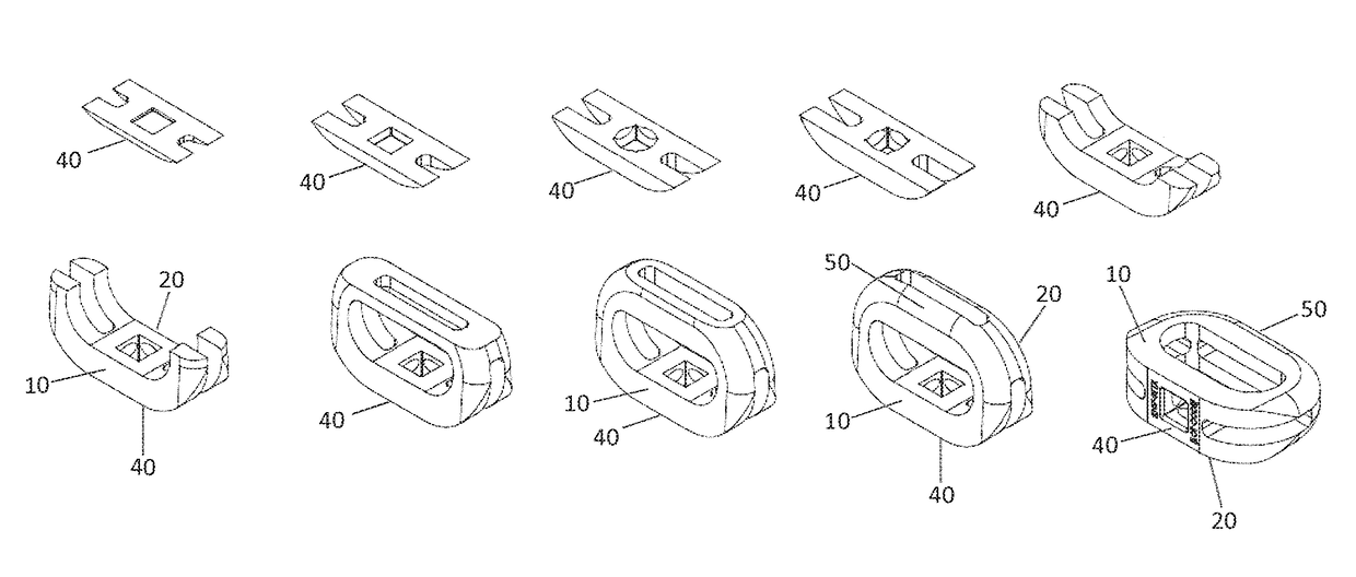 Processes for additively manufacturing orthopedic implants