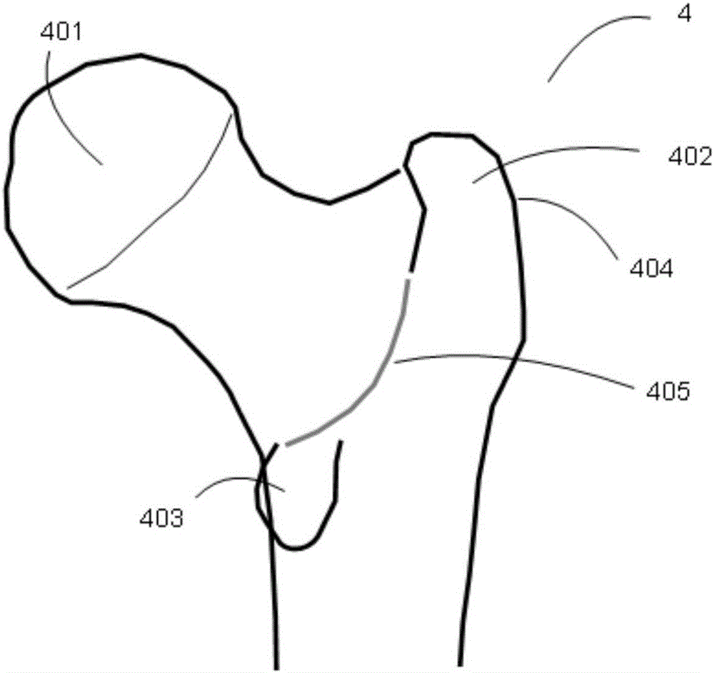 Proximal femur operation positioning and orientating system and manufacturing method thereof