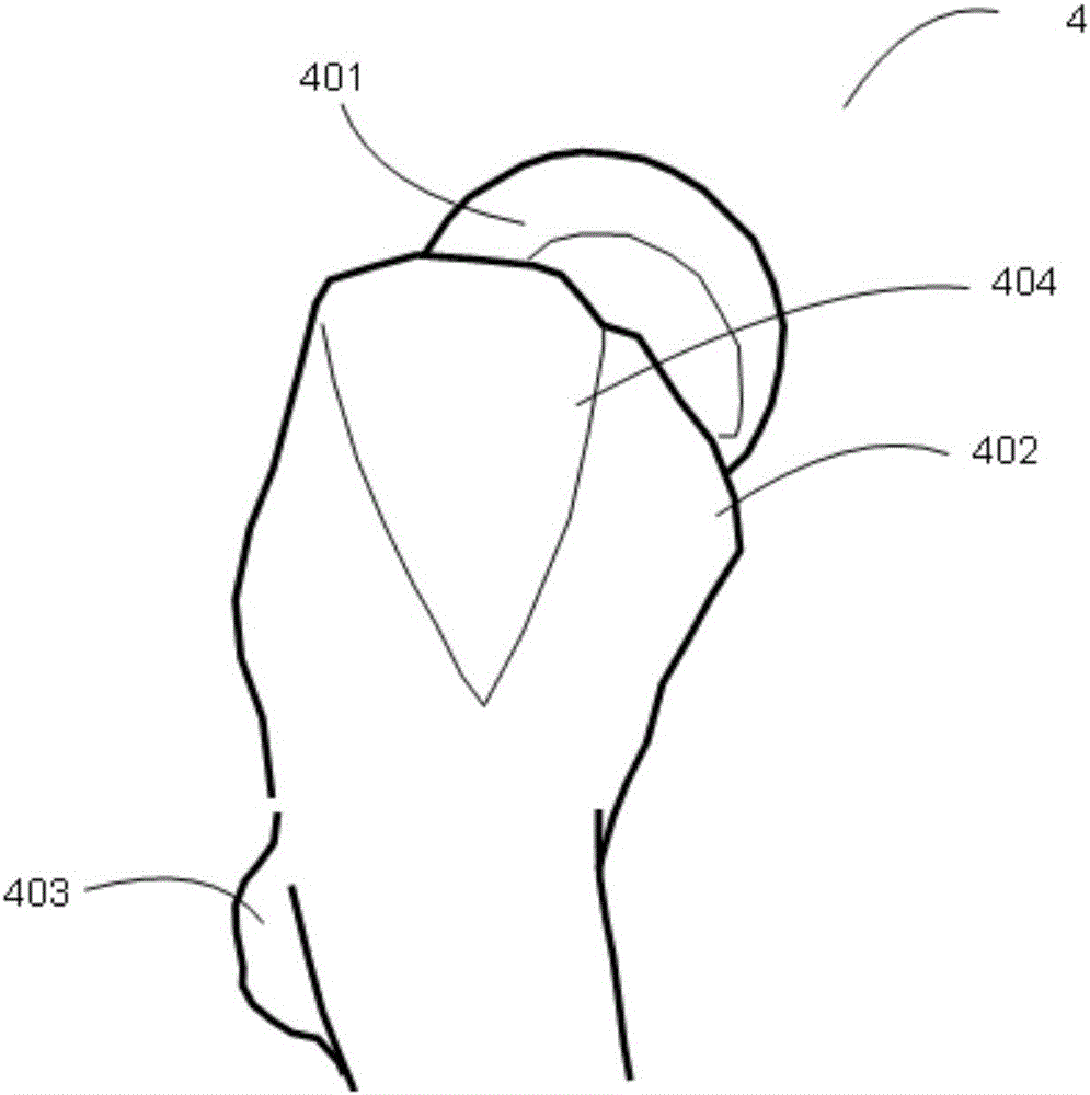 Proximal femur operation positioning and orientating system and manufacturing method thereof