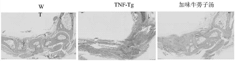 Compound preparation for treating rheumatoid arthritis and preparation method of compound preparation