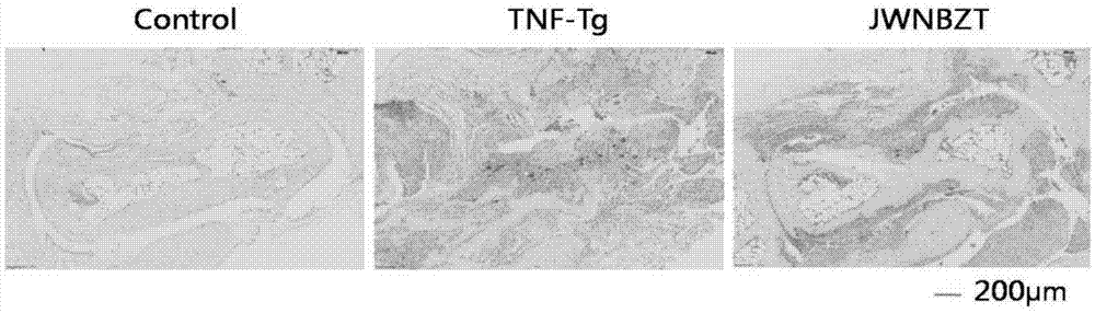 Compound preparation for treating rheumatoid arthritis and preparation method of compound preparation