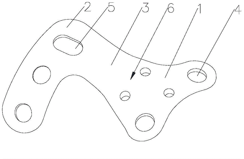 Talonavicular fusion plate