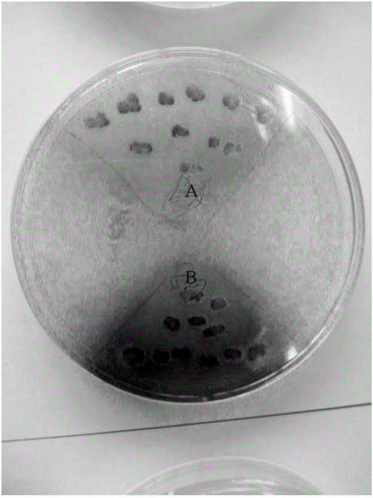 Culture medium for screening high-yield glutamine transaminase strain in high-throughput mode