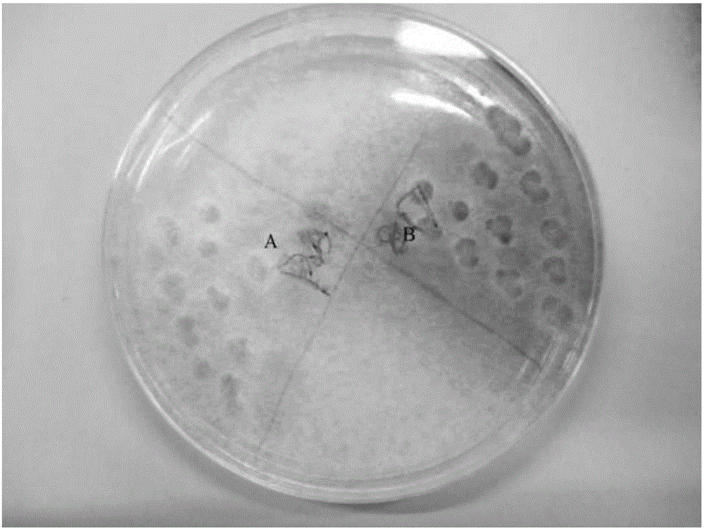 Culture medium for screening high-yield glutamine transaminase strain in high-throughput mode