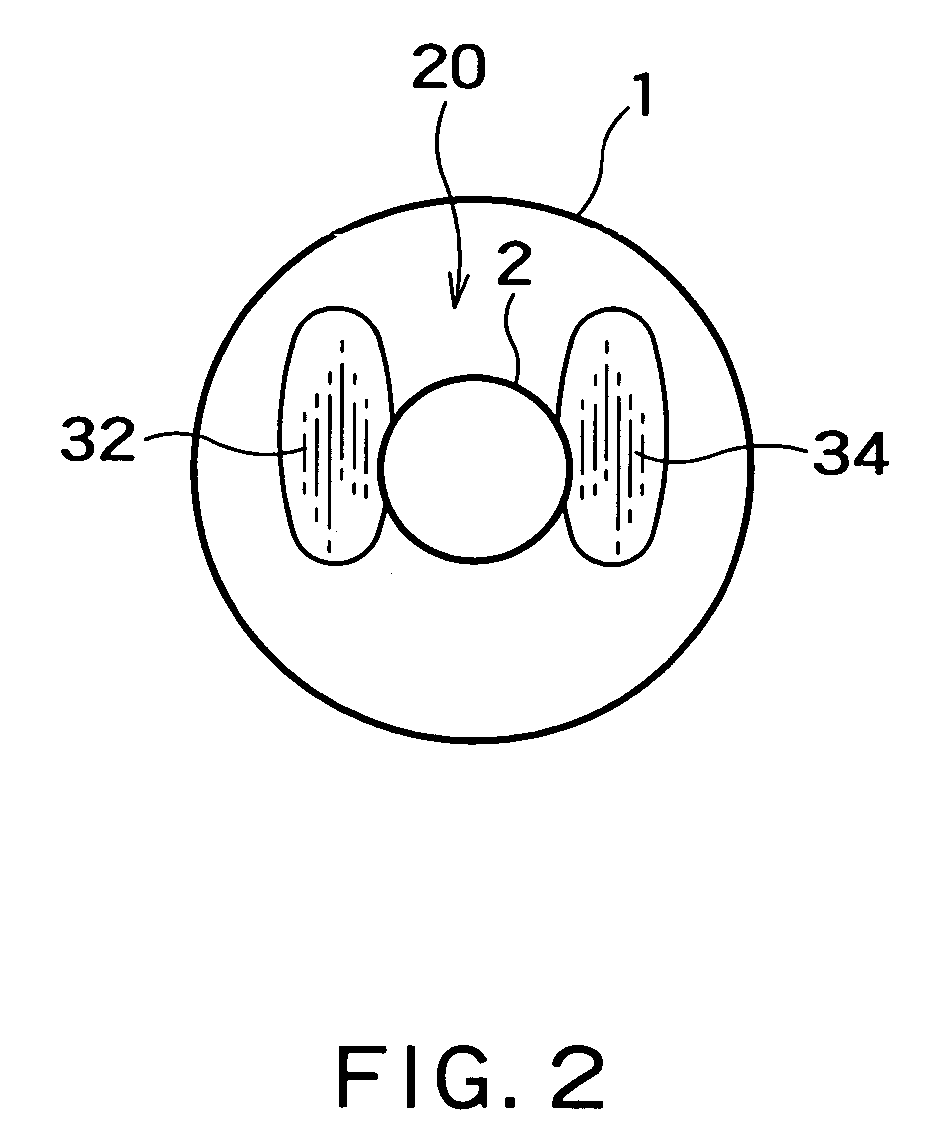 Radio-frequency thermal balloon catheter