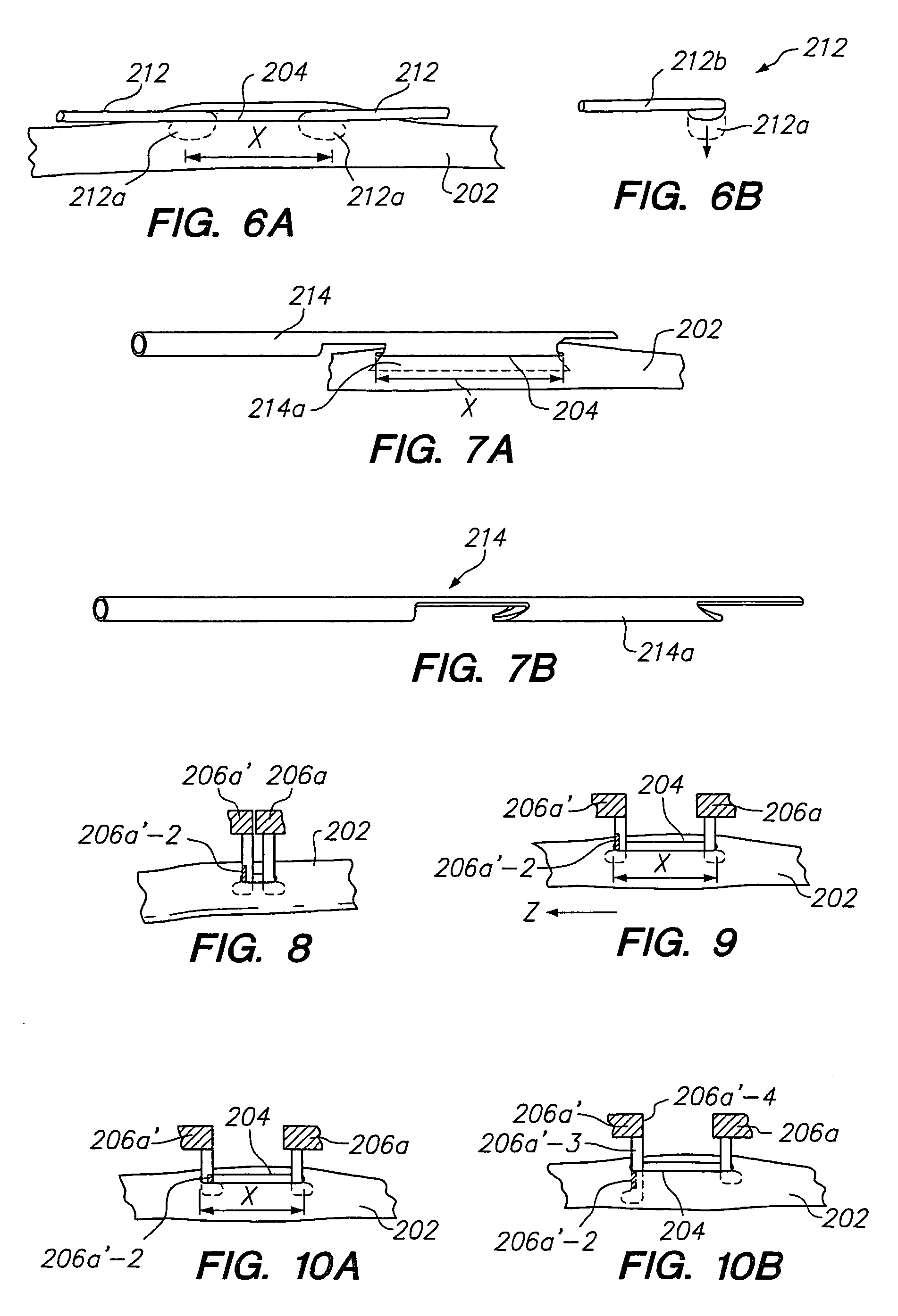 Method for tensioning an incision during an anastomosis procedure