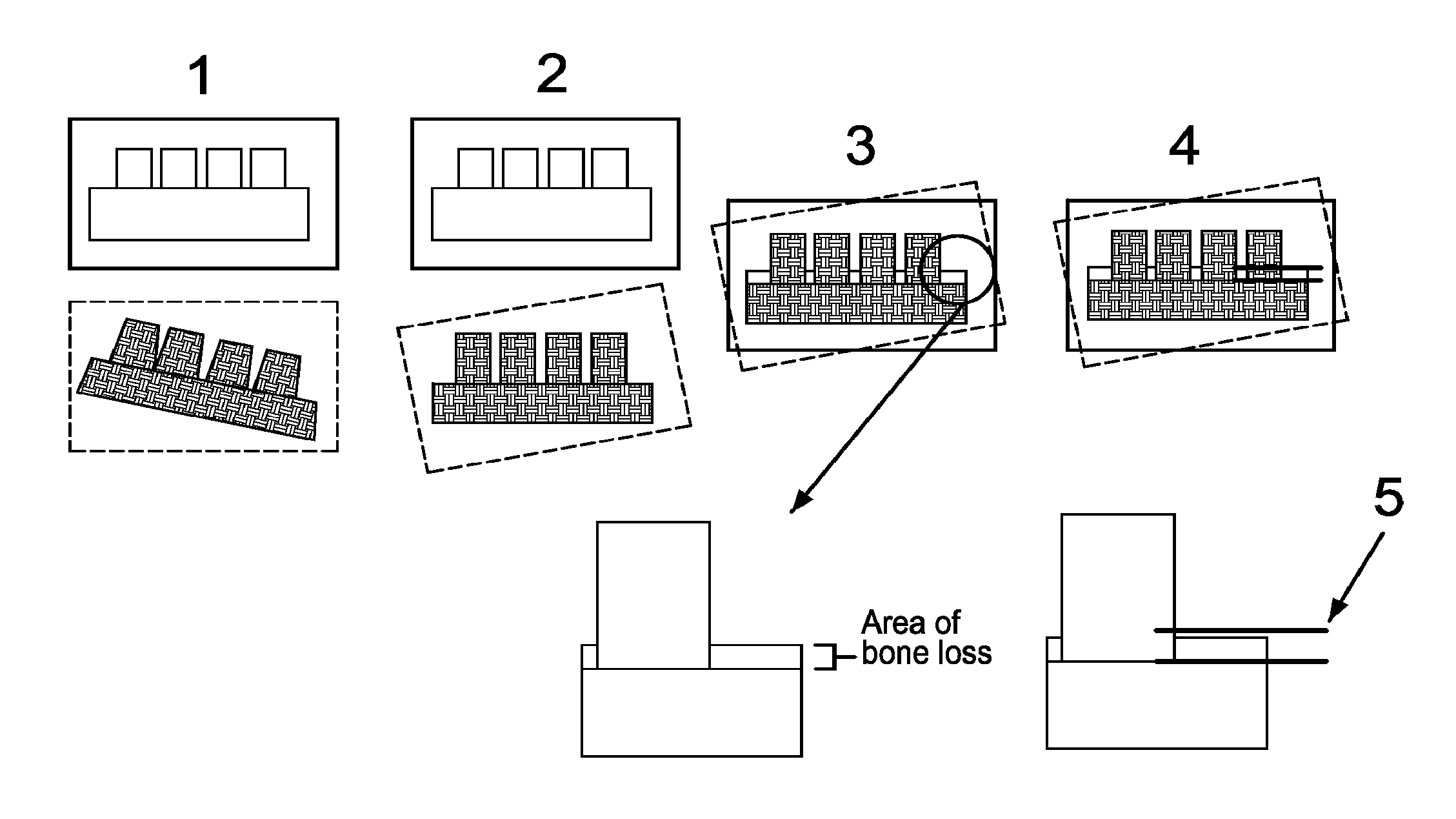 System and method for detecting and tracking change in dental X-rays and dental images