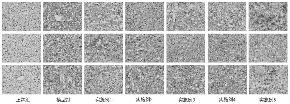 Oligosaccharide-based lipid-lowering liver-protecting formulated food for special medical purposes and preparation method thereof