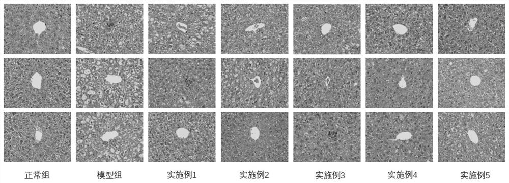 Oligosaccharide-based lipid-lowering liver-protecting formulated food for special medical purposes and preparation method thereof