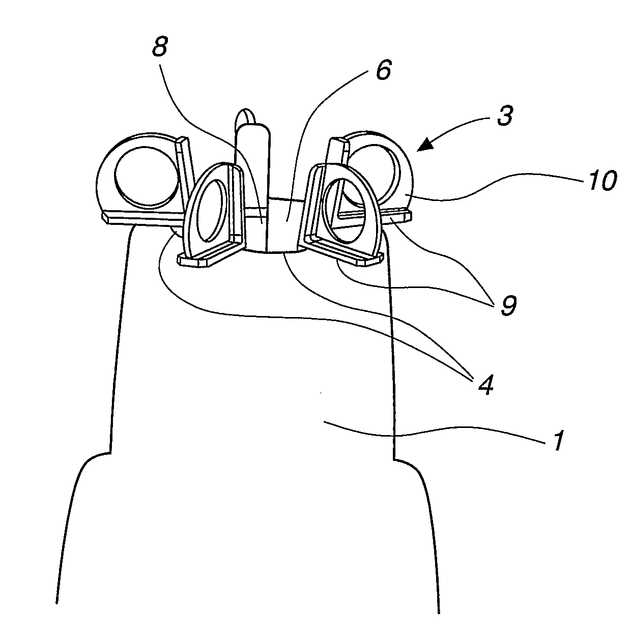 Device For Stretching an Elastically Expandable Body