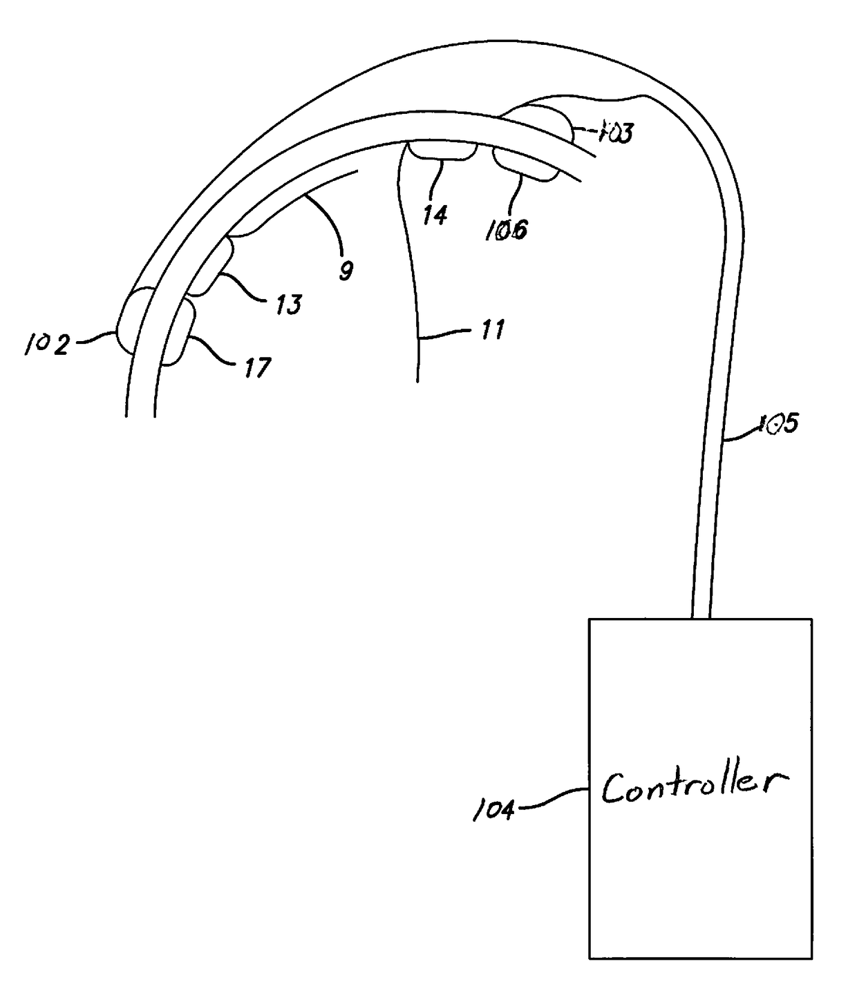 Cortical implant system for brain stimulation and recording