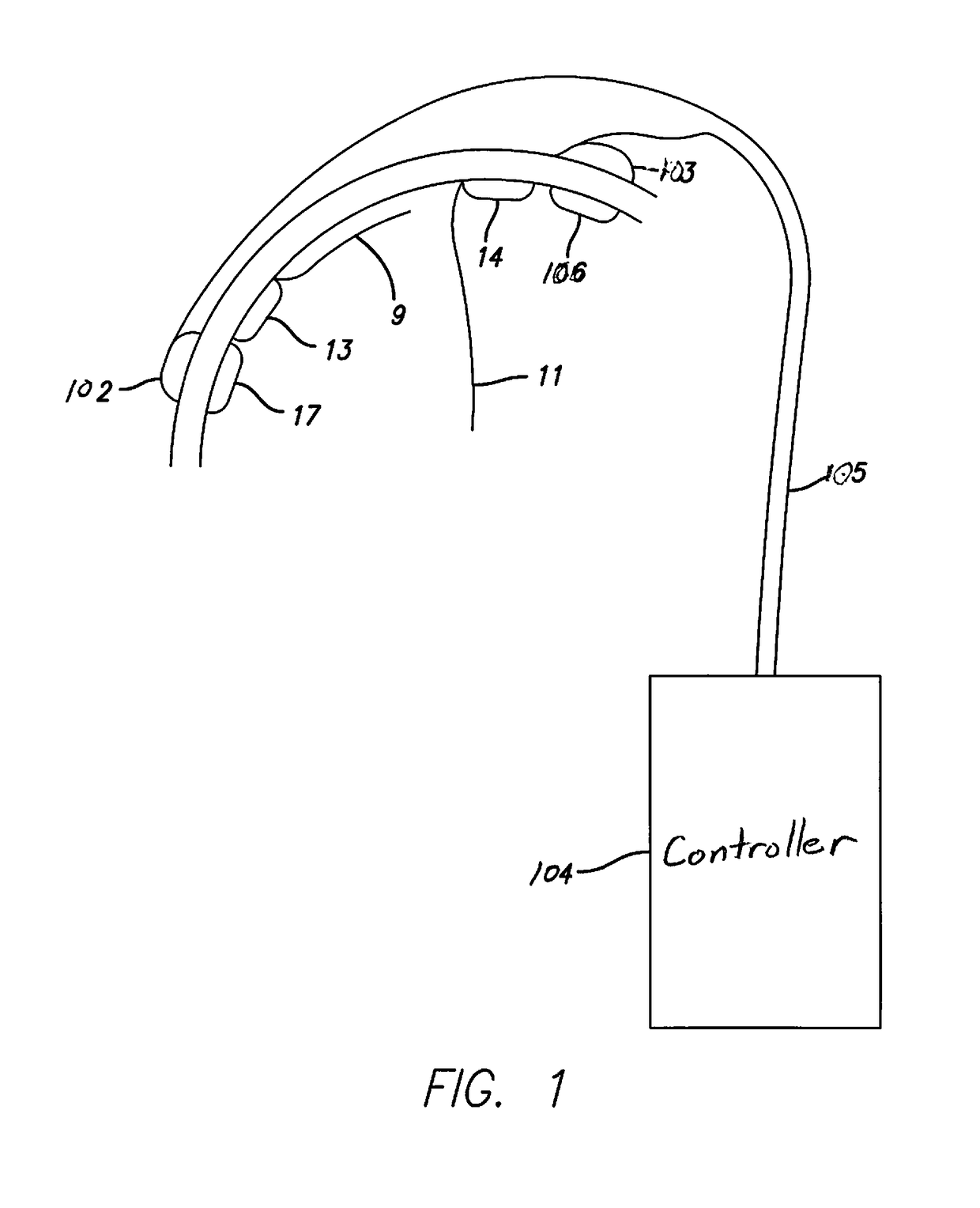 Cortical implant system for brain stimulation and recording