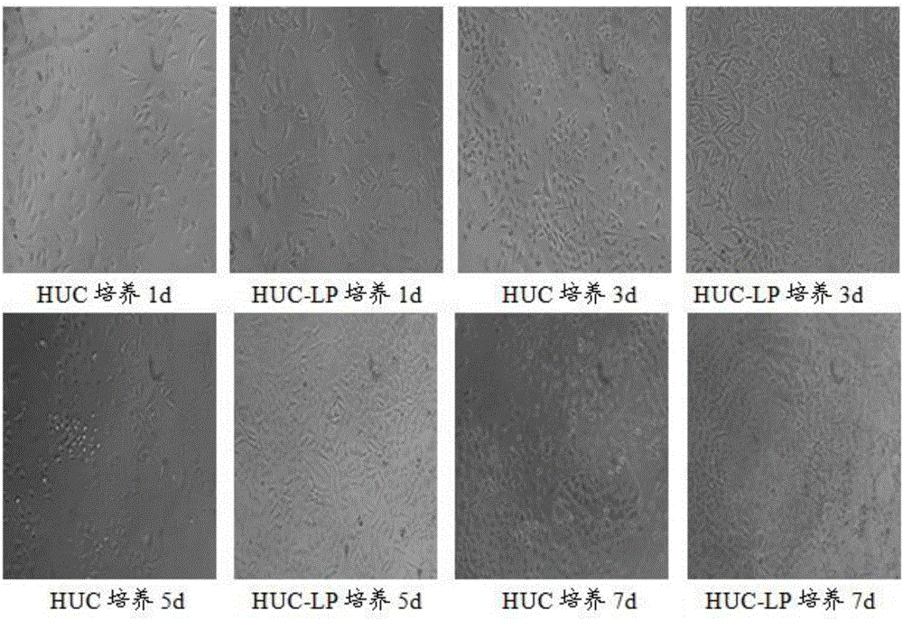 Human umbilical cord MSC (mesenchymal stem cell) serum-free medium liposome freeze-dried powder as well as preparation method and application thereof