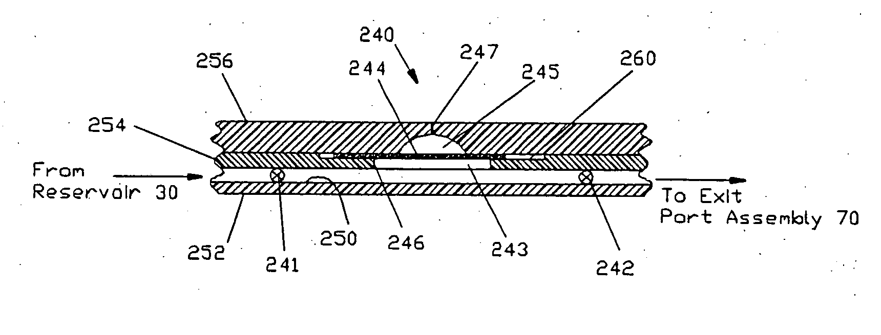 Laminated patient infusion device