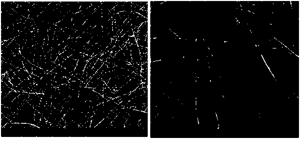 Medical porous fiber membrane and preparation method thereof