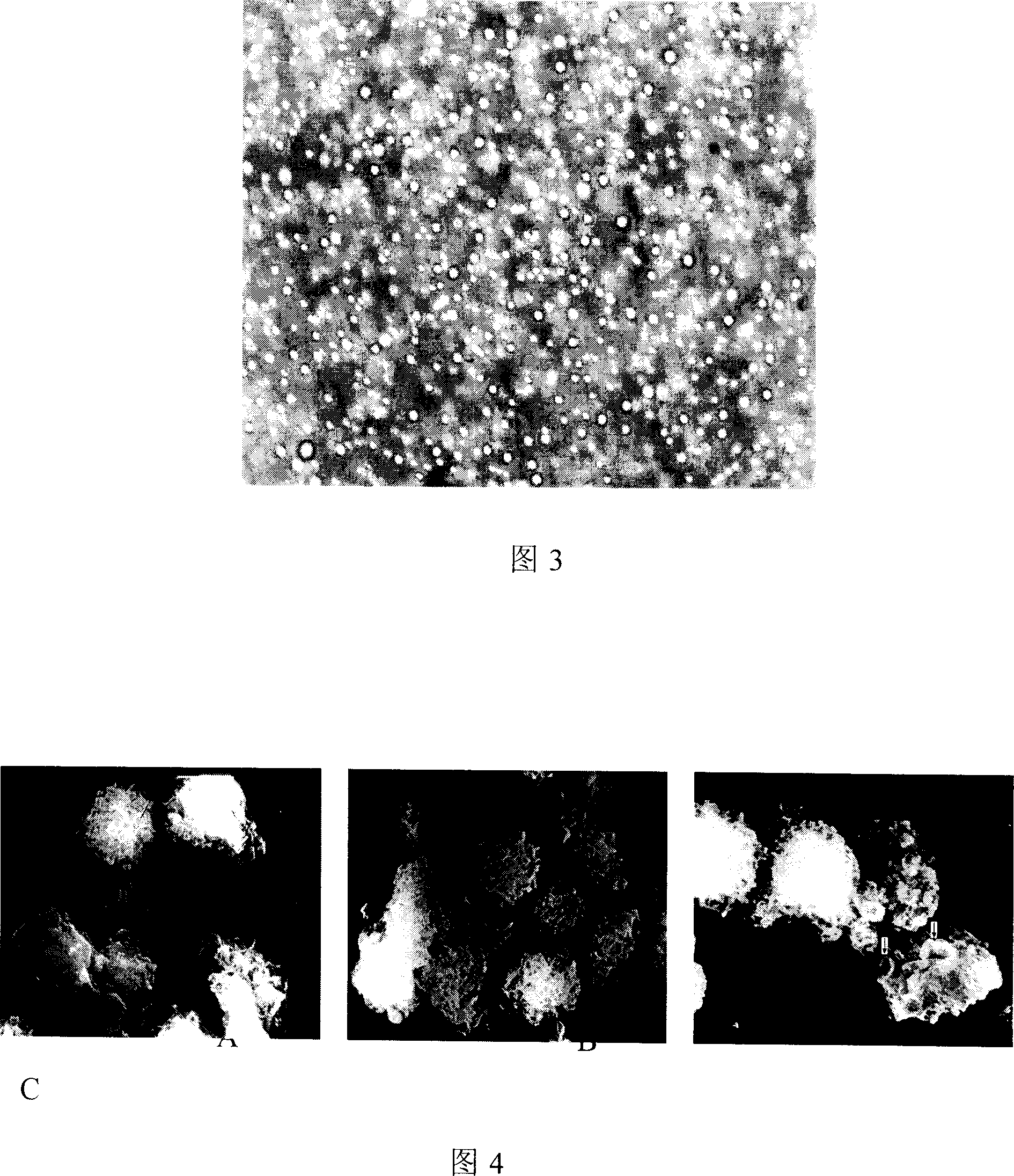 Ultrasonic microvesicle as immuno adjuvant and vaccine carrier