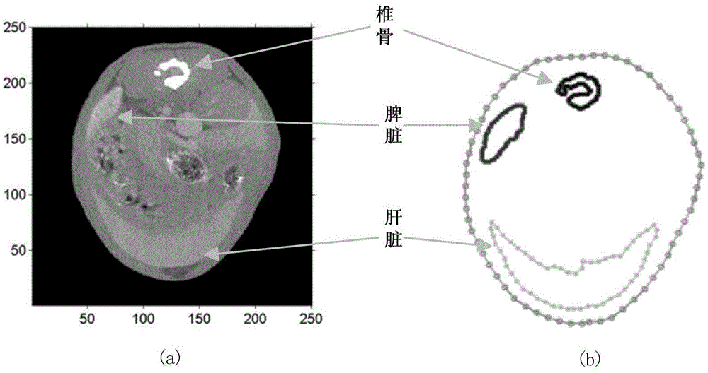 An Image Reconstruction Algorithm of Dot/xct Dual Mode Imaging Based on Boundary Elements