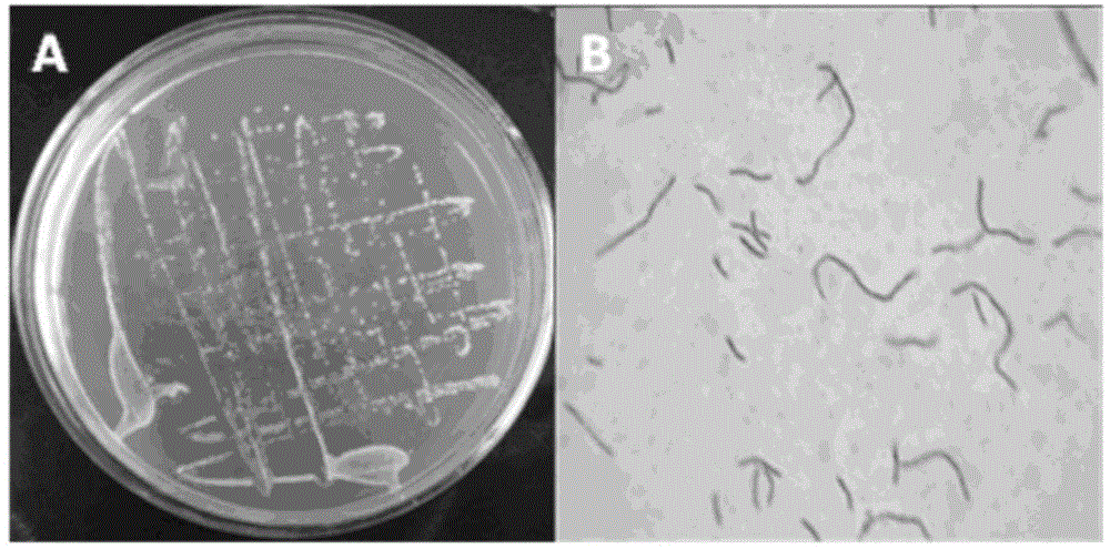 Preparation and application of composite microecological feed additive