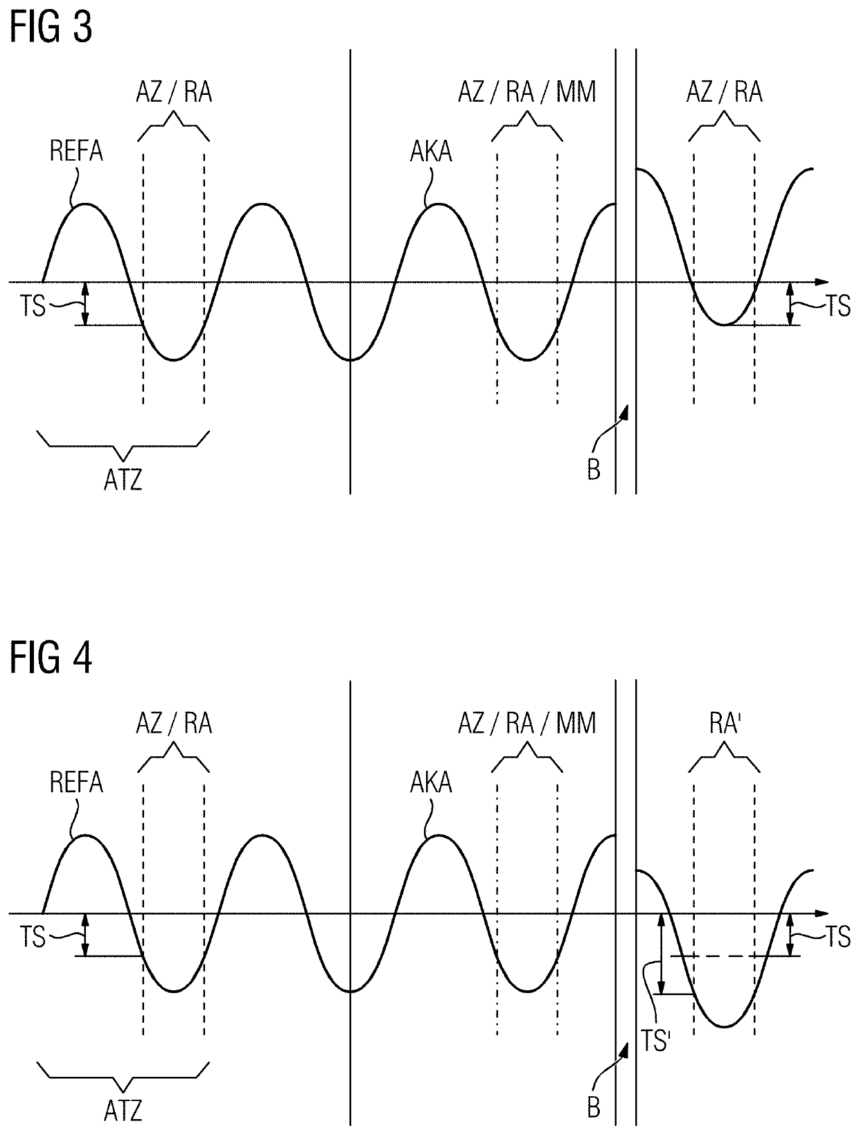 Monitoring a respiratory curve