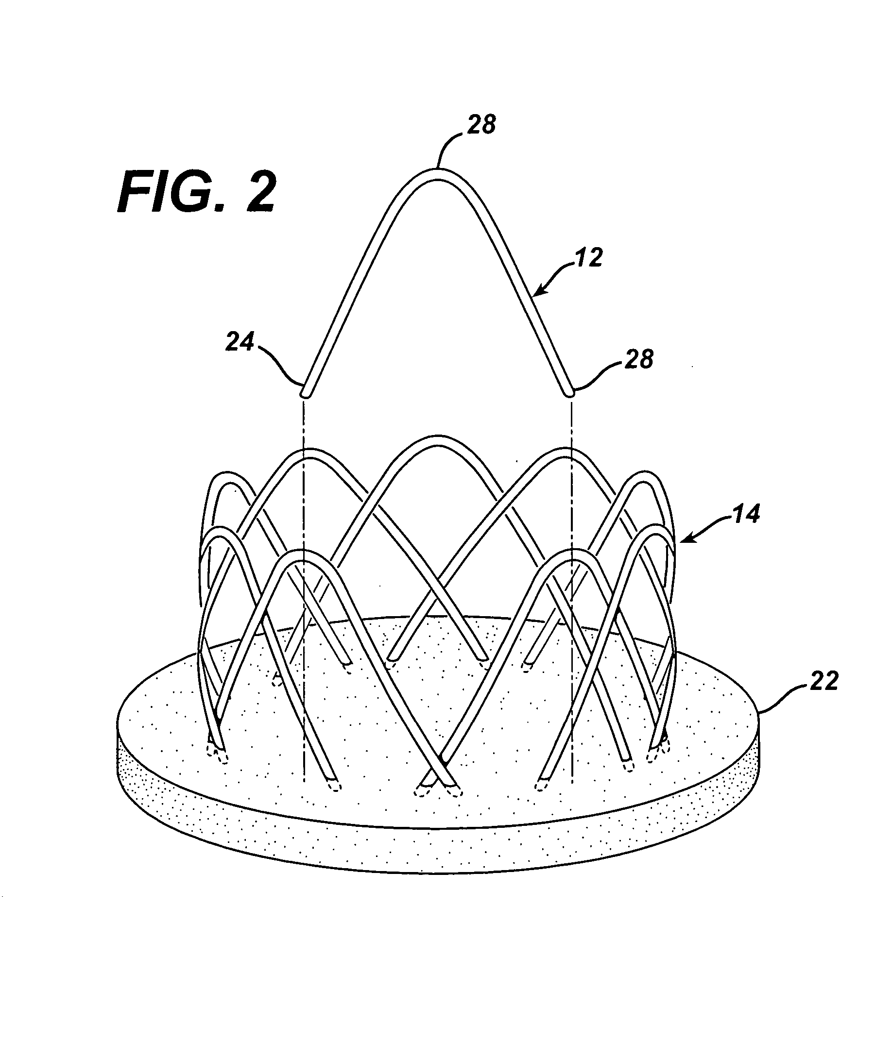 Unfolding anastomosis ring device