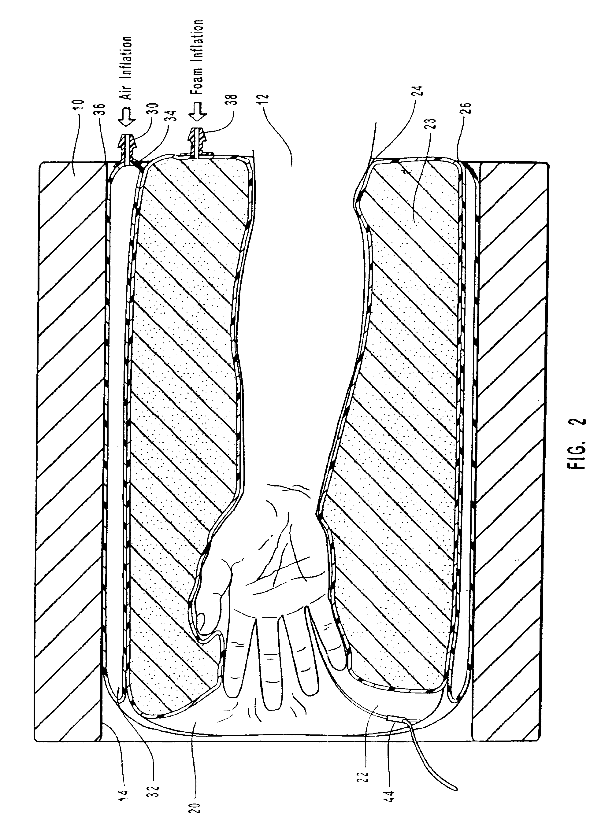 Restraining apparatus and method for use in imaging procedures