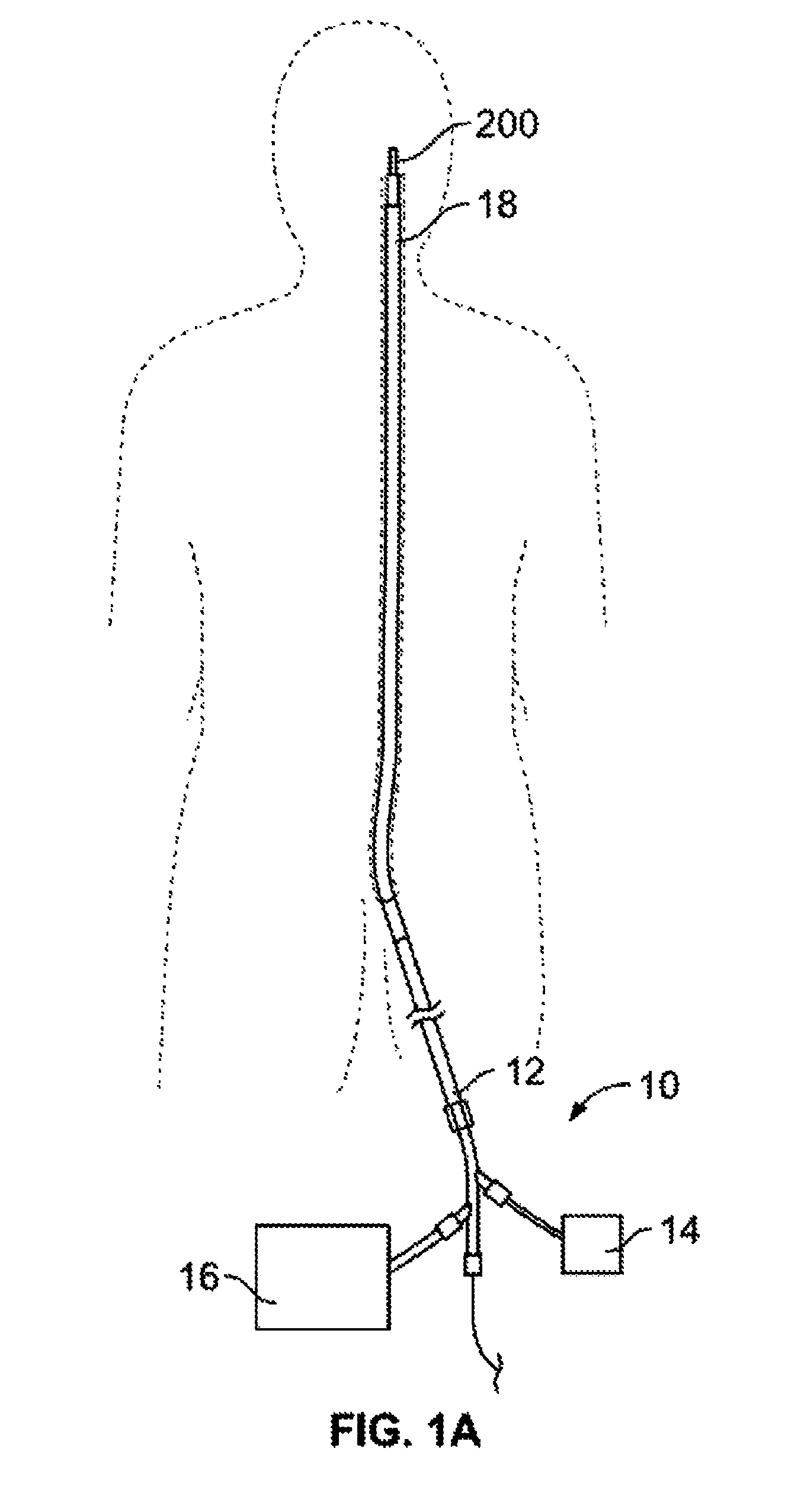 Retrieval systems and methods for use thereof