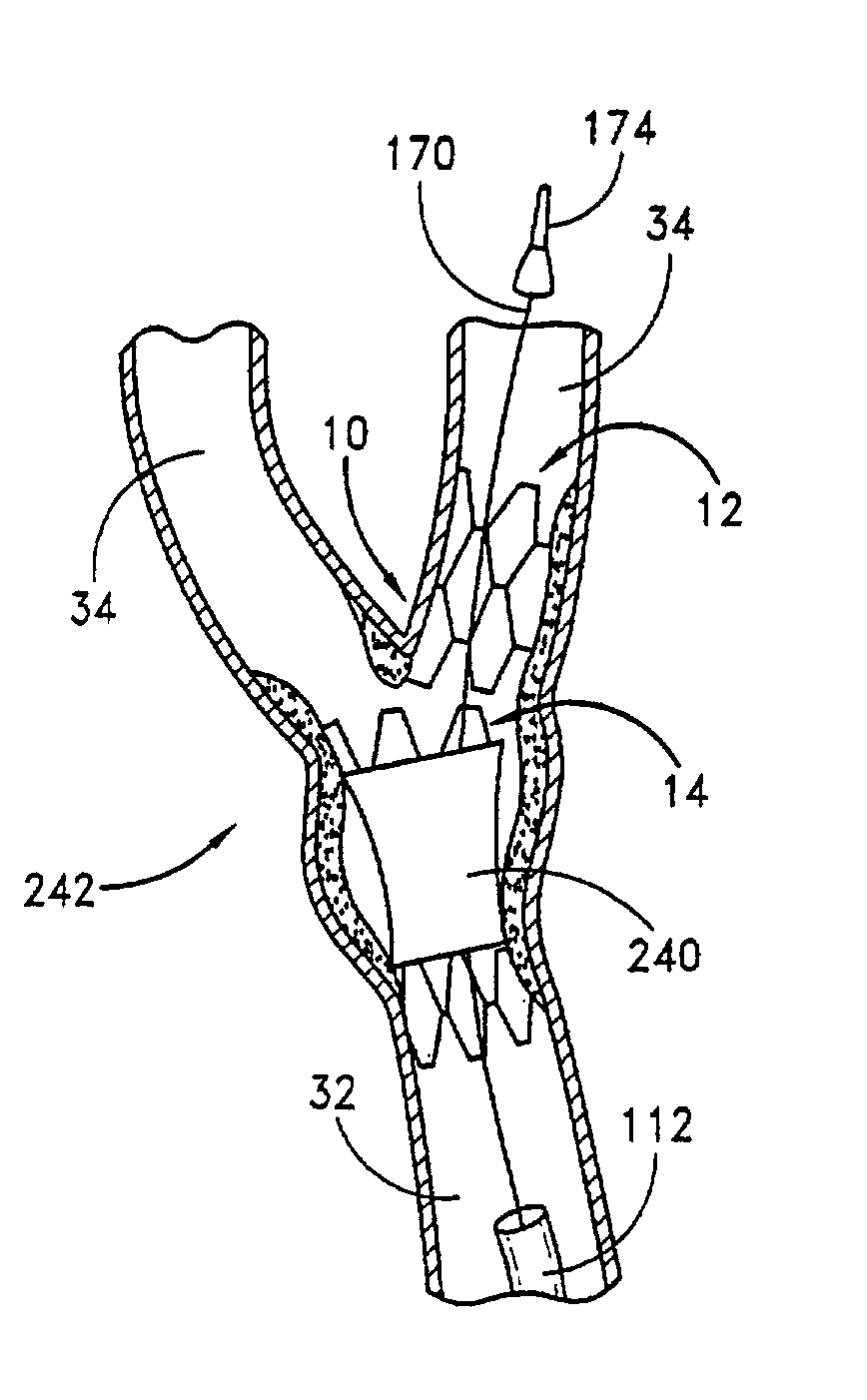 Noncylindrical stent deployment for treating vascular bifurcations